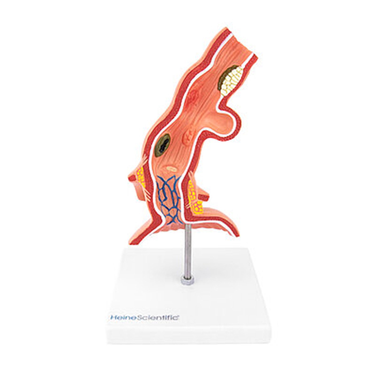 csm_139049_Oesophagus_mit_Erkrankungen_2_0fbe3f965a